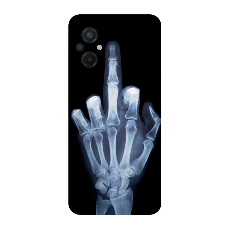 Dla Poco M5 2022 4G przypadku  – Phone Cases Liverpool recenzja i cena